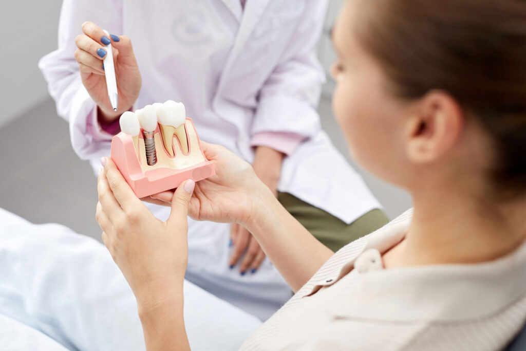 Tooth implatation model